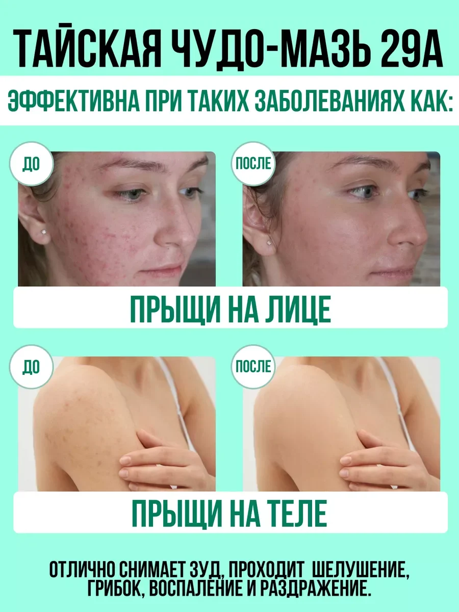 Тайская мазь от грибка, псориаза, экземы А-29, 7,5 гр. / "Тайская Аптека"