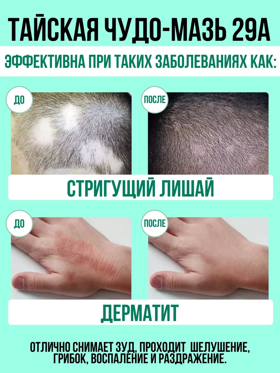 Тайская мазь от грибка, псориаза, экземы А-29, 7,5 гр. / "Тайская Аптека"