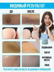 Тайский отбеливающий крем, для интимной зоны, локтей и подмышек, Isme, 5 гр