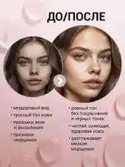 EDEN MICROBIOME Тонер для лица с пробиотиками увлажняющий