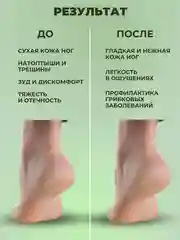 Гладенькие пяточки, наносредство для удаления натоптышей, 500 мл