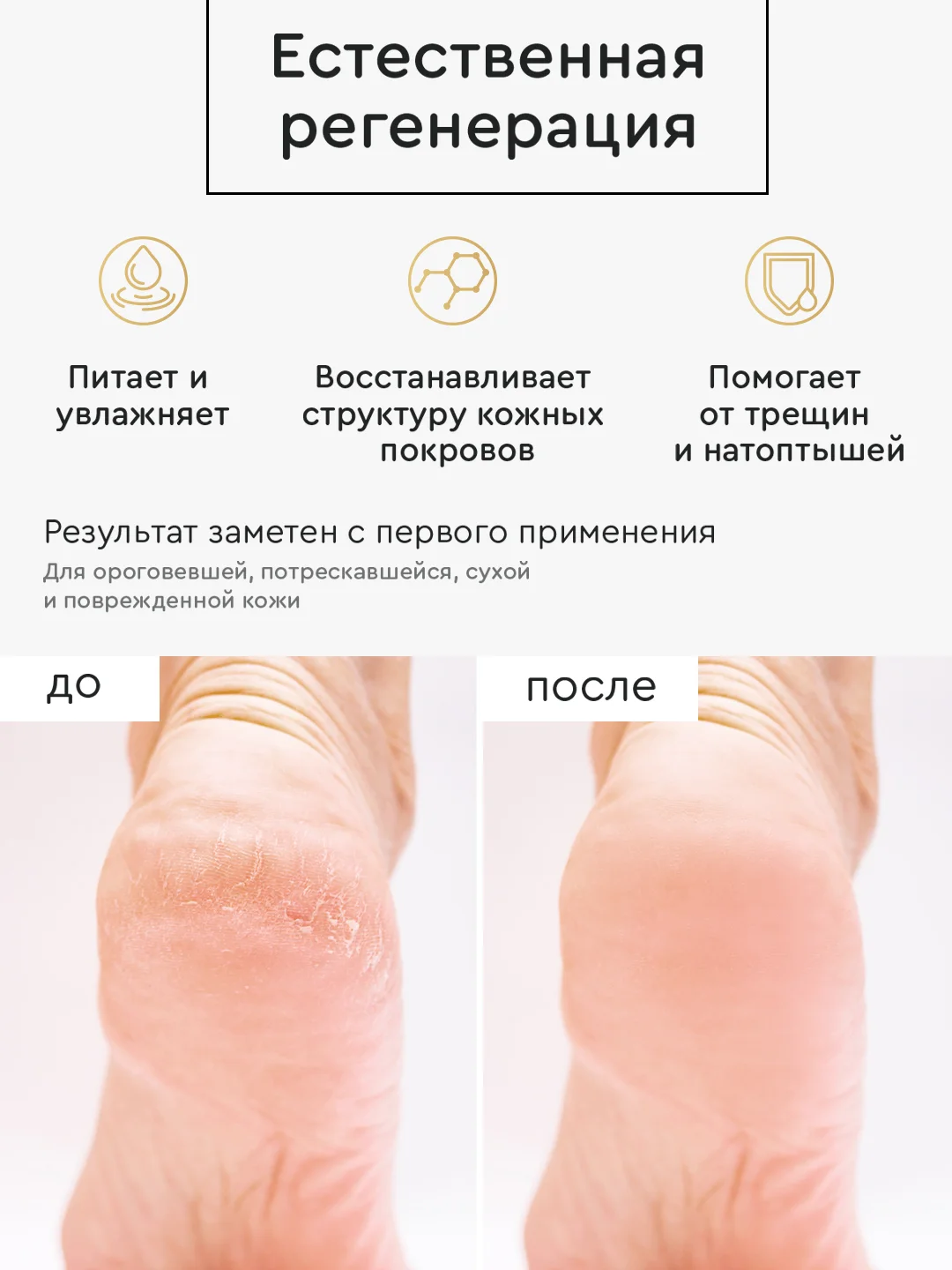 Крем воск СПА-уход с пантенолом и мочевиной, для сухой кожи рук и ног, 100 мл