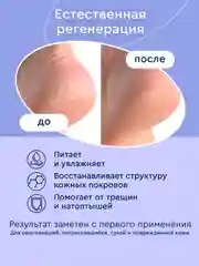 Крем воск от трещин и шелушений, для сухой кожи рук и ног, 100 мл