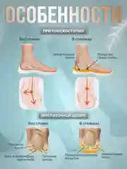 Стельки для обуви, анатомические стельки