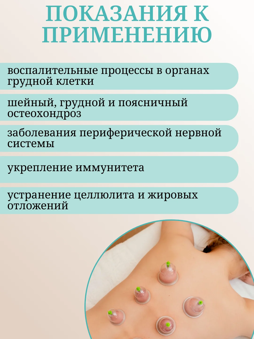 Массажные вакуумные банки, с насосом для хиджамы и массажа, 6-12 штук