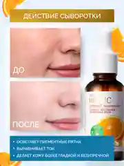Красный сыворотка для лица увлажняющая, осветляющая, с ниацинамидом, для проблемной кожи, 30 мл