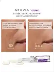 АКАВИЯ PEPTID Увлажняющая сыворотка для лица с гиалуроновой кислотой