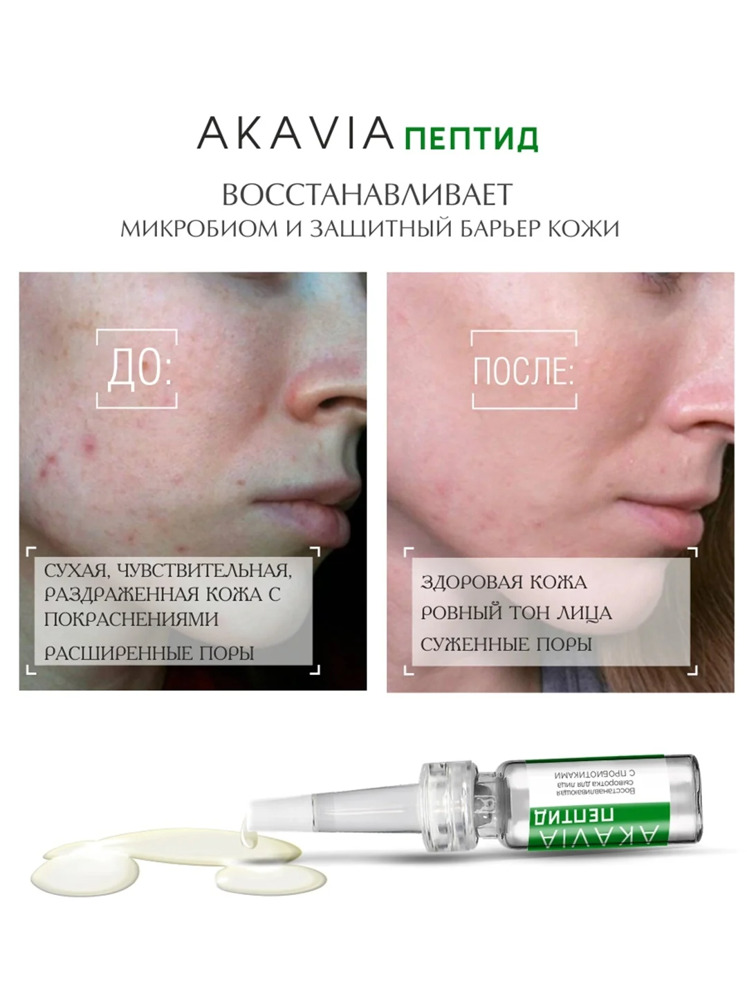 АКАВИЯ PEPTID Восстанавливающая сыворотка для лица с пробиотиками