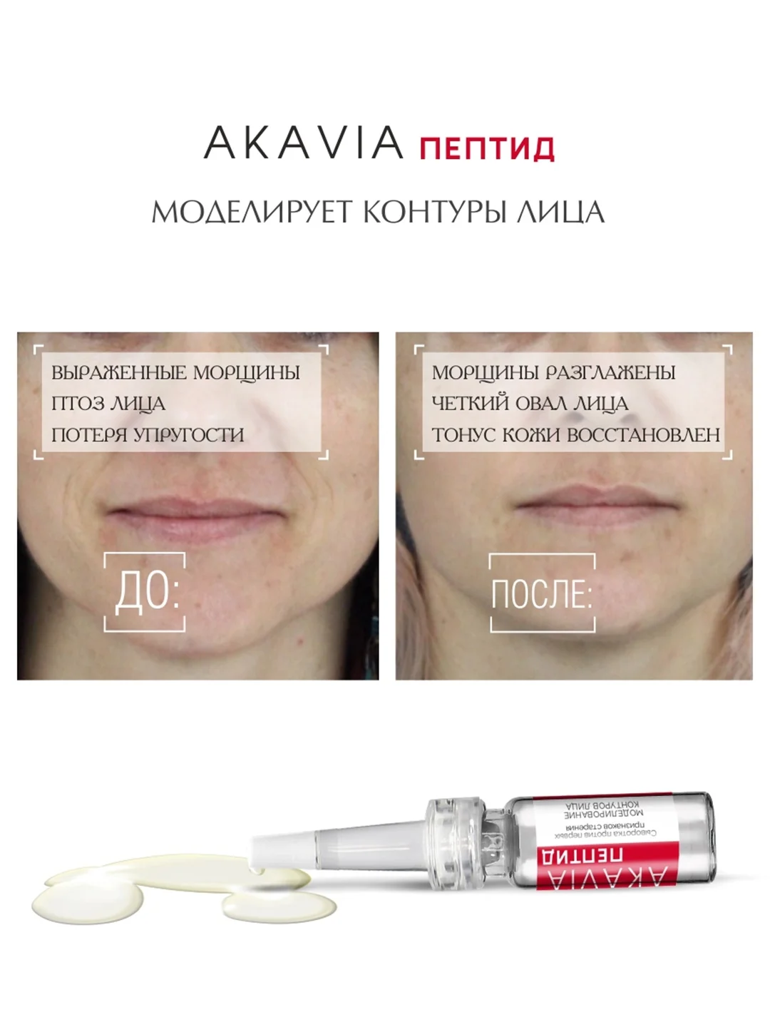 АКАВИЯ PEPTID Сыворотка против первых признаков старения, моделирование контуров лица