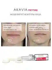 АКАВИЯ PEPTID Сыворотка против первых признаков старения, моделирование контуров лица
