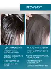 РИНФОЛТИЛ PRO Спрей для волос от выпадения для жирной кожи головы