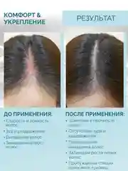 РИНФОЛТИЛ PRO Спрей для волос от выпадения для чувствительной кожи головы 100 мл