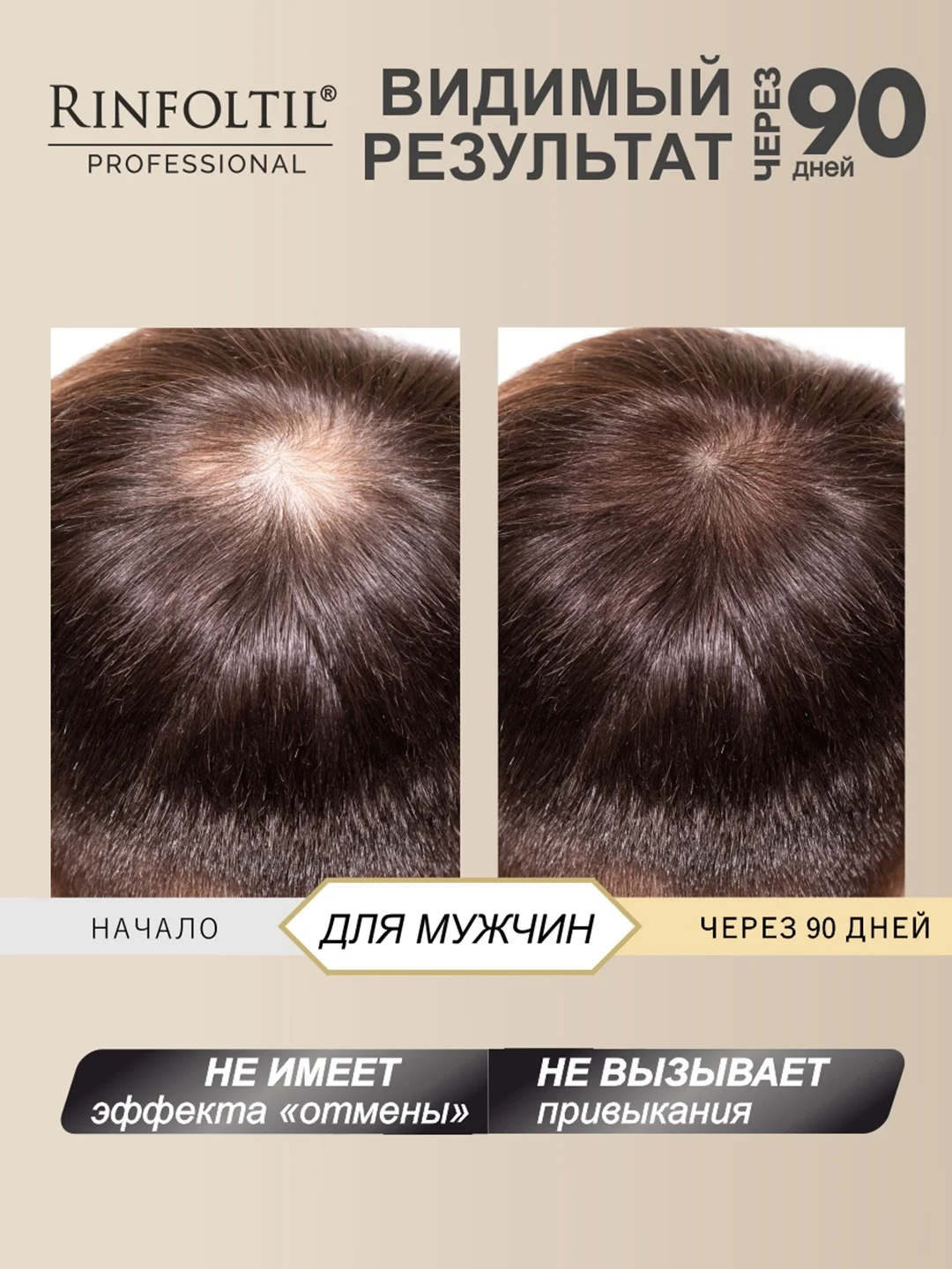 РИНФОЛТИЛ СЕРЕНОА лосьон для мужчин для улучшения качества волос и ухода за кожей головы