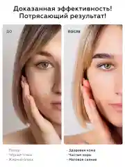Гель для умывания лица с AHA кислотами от прыщей и акне
