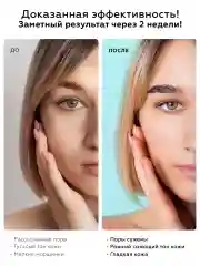 Пилинг для лица с миндальной кислотой мягкий