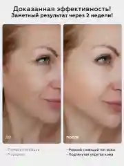 Ампульная сыворотка для лица увлажняющая успокаивающая