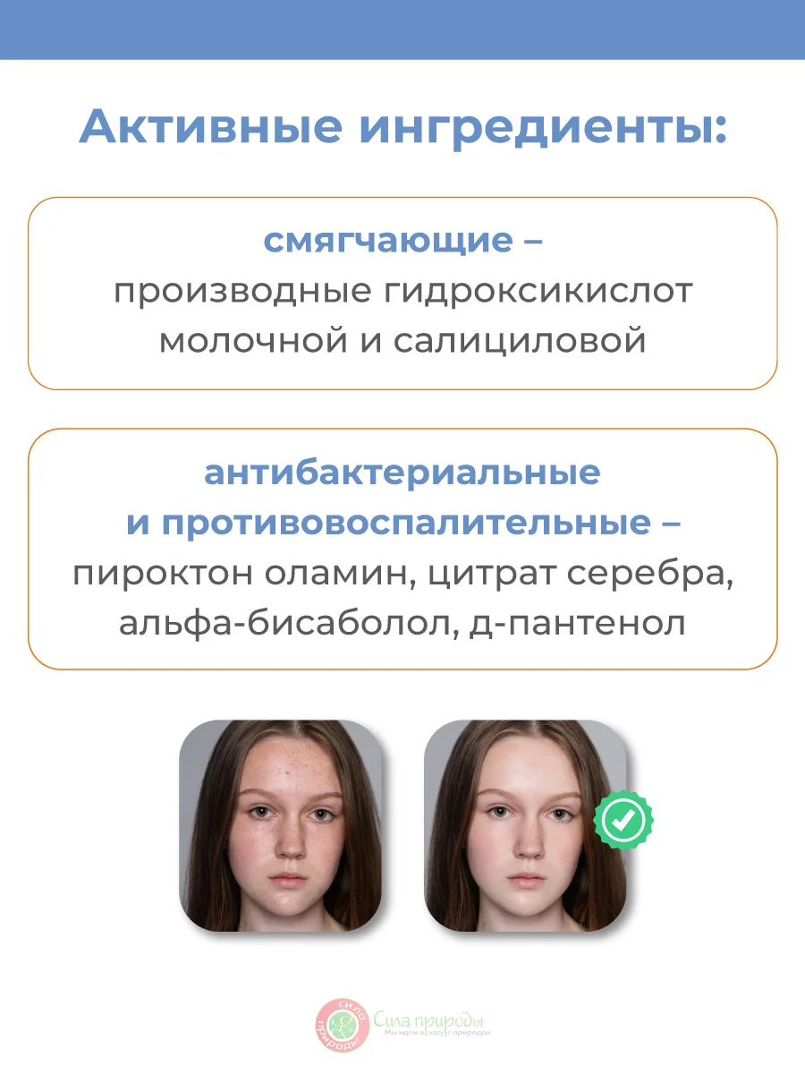 Средство для умывания для жирной и проблемной кожи лица, склонной к акне, 200 мл.