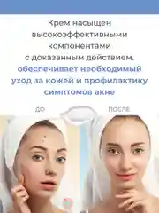 Крем день-ночь для жирной и проблемной кожи лица, склонной к акне, 40 мл