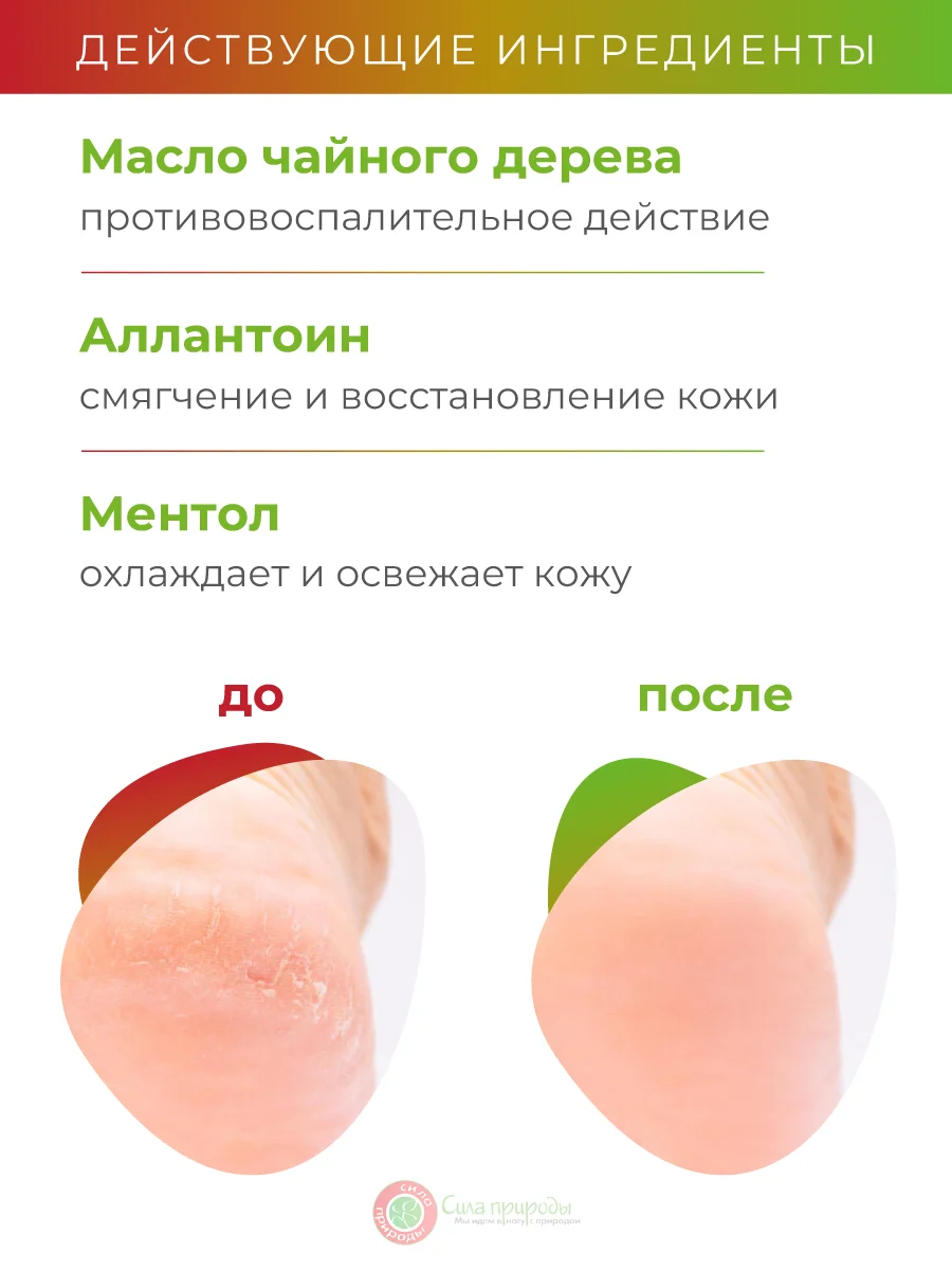 Спрей для ног МИКОТРИН антибактериальный с дезодорирующим эффектом, 150 мл.