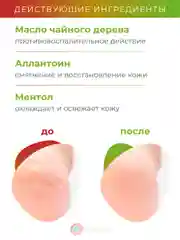 Спрей для ног МИКОТРИН антибактериальный с дезодорирующим эффектом, 150 мл.
