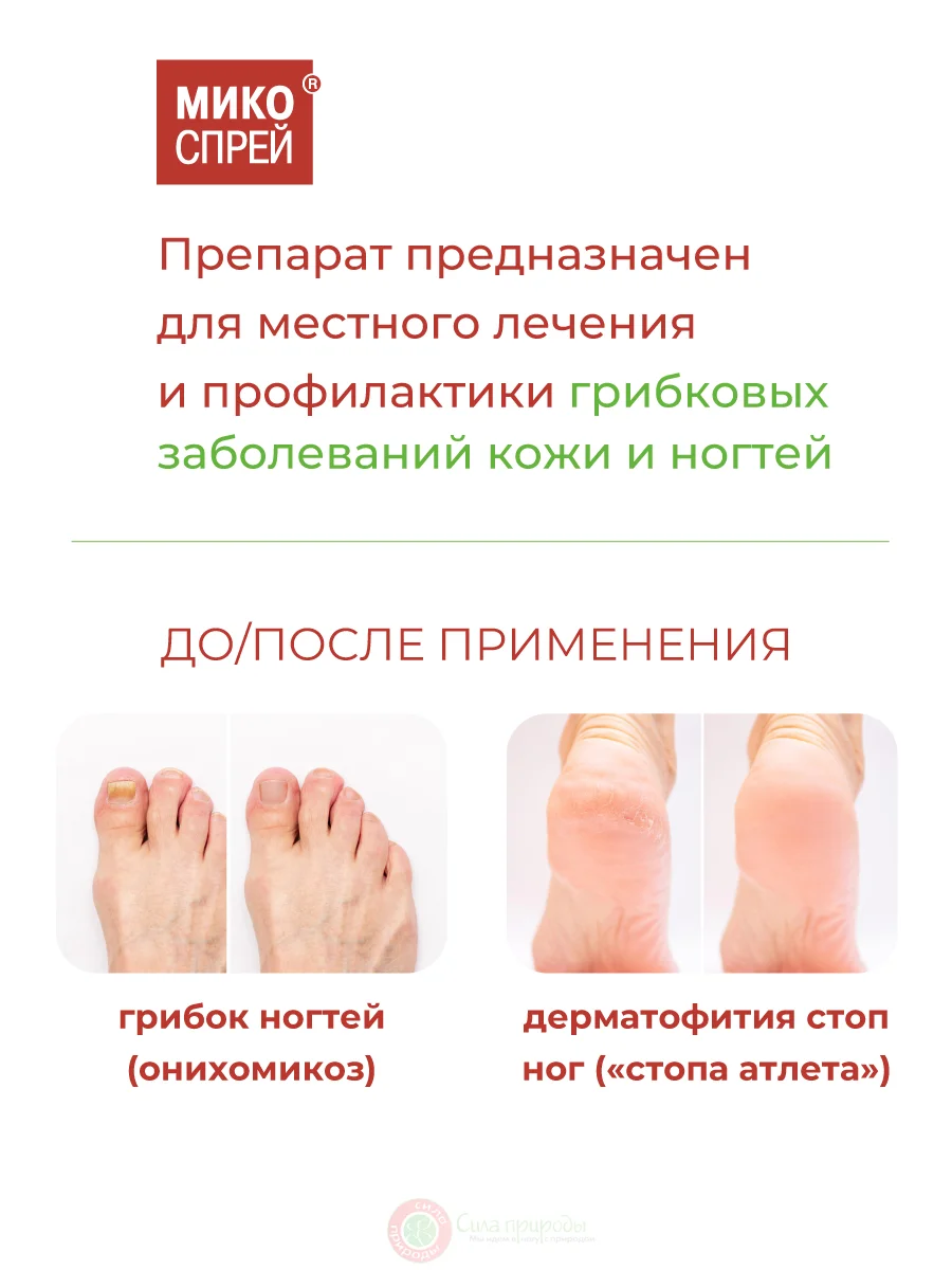 Микоспрей, Клотримазол лосьон для ногтей и кожи, 15 мл