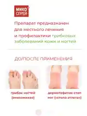 Микоспрей, Клотримазол лосьон для ногтей и кожи, 15 мл