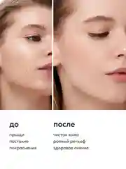 Likato Professional Лосьон-спрей от прыщей для лица и тела, 200 мл