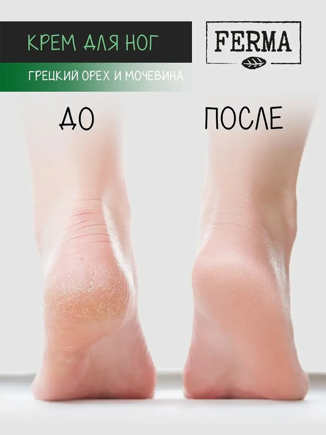 Набор кремов Ferma, для рук, ног и лица, 3 штуки