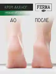 Набор кремов Ferma, для рук, ног и лица, 3 штуки
