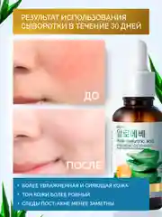 Красный сыворотка для лица увлажняющая, осветляющая, с ниацинамидом, для проблемной кожи, 30 мл
