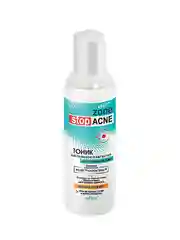 Тоник для лица Белита Zone Stop ACNE, для глубокой очистки пор, 150 мл