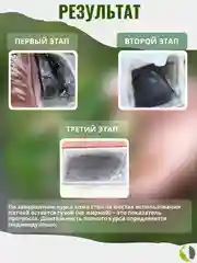 Kinoki Детокс патчи (пластырь) для ног для выведения тоскинов, киноки пластырь. 5 пар