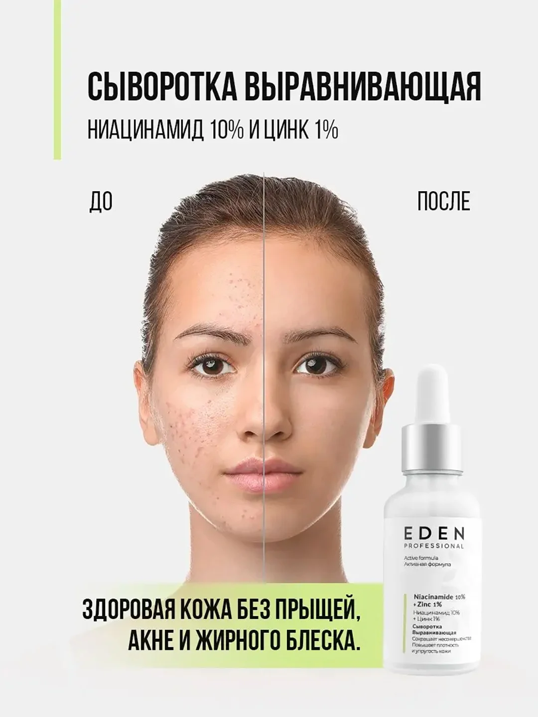 EDEN PROFESSIONAL сыворотка для лица ,против прыщей, акне с ниацинамидом и цинком 30 мл