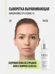 EDEN PROFESSIONAL сыворотка для лица ,против прыщей, акне с ниацинамидом и цинком 30 мл