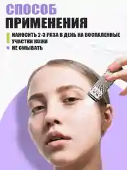 Точечный гель аппликатор от прыщей и акне STOP ACNE, 30 мл
