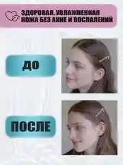 Крем гель для лица от прыщей и акне STOP ACNE, 50 мл