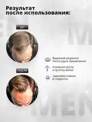 Шампунь для роста волос профессиональный никотиновый 500 мл, мужская серия