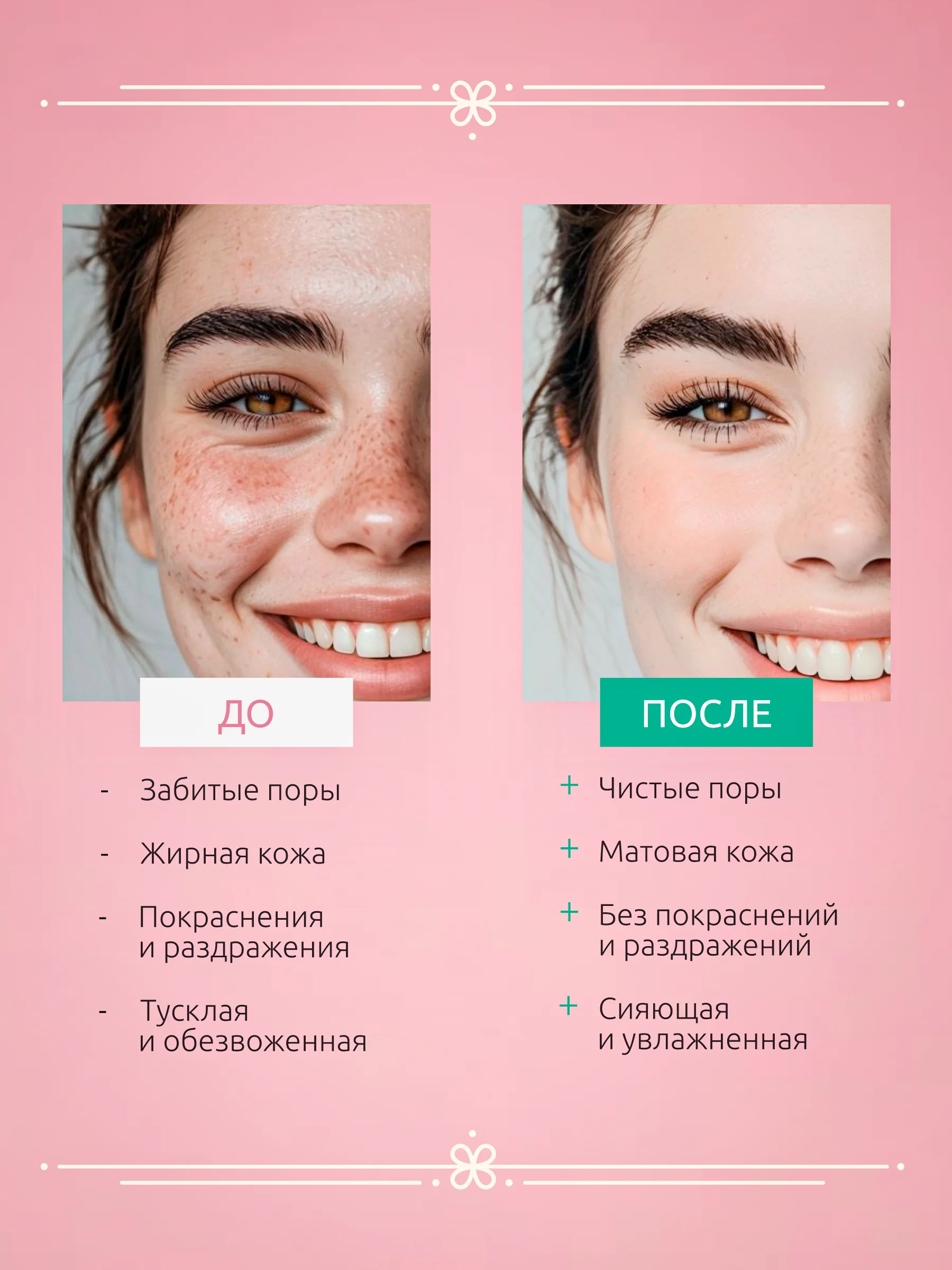 Пенка-мусс для умывания 150 мл с молочной кислотой, ALOE VERA и экстрактом ламинарии