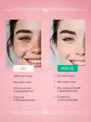 Пенка-мусс для умывания 150 мл с молочной кислотой, ALOE VERA и экстрактом ламинарии