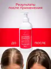 Шампунь для роста волос профессиональный никотиновый 500 мл, женская серия