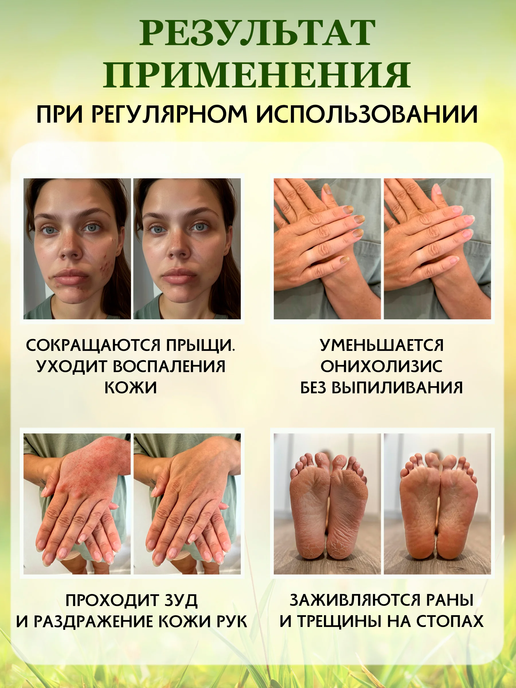 Мульти паста Смарт мастер органик лечебная заживляющая, от грибка, трещин, онихолизиса