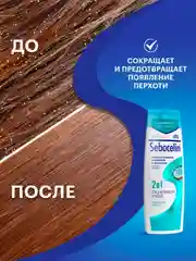 SEBOCELIN Гиалуроновый шампунь и бальзам 2 в 1 против перхоти Райский кокос 400 мл