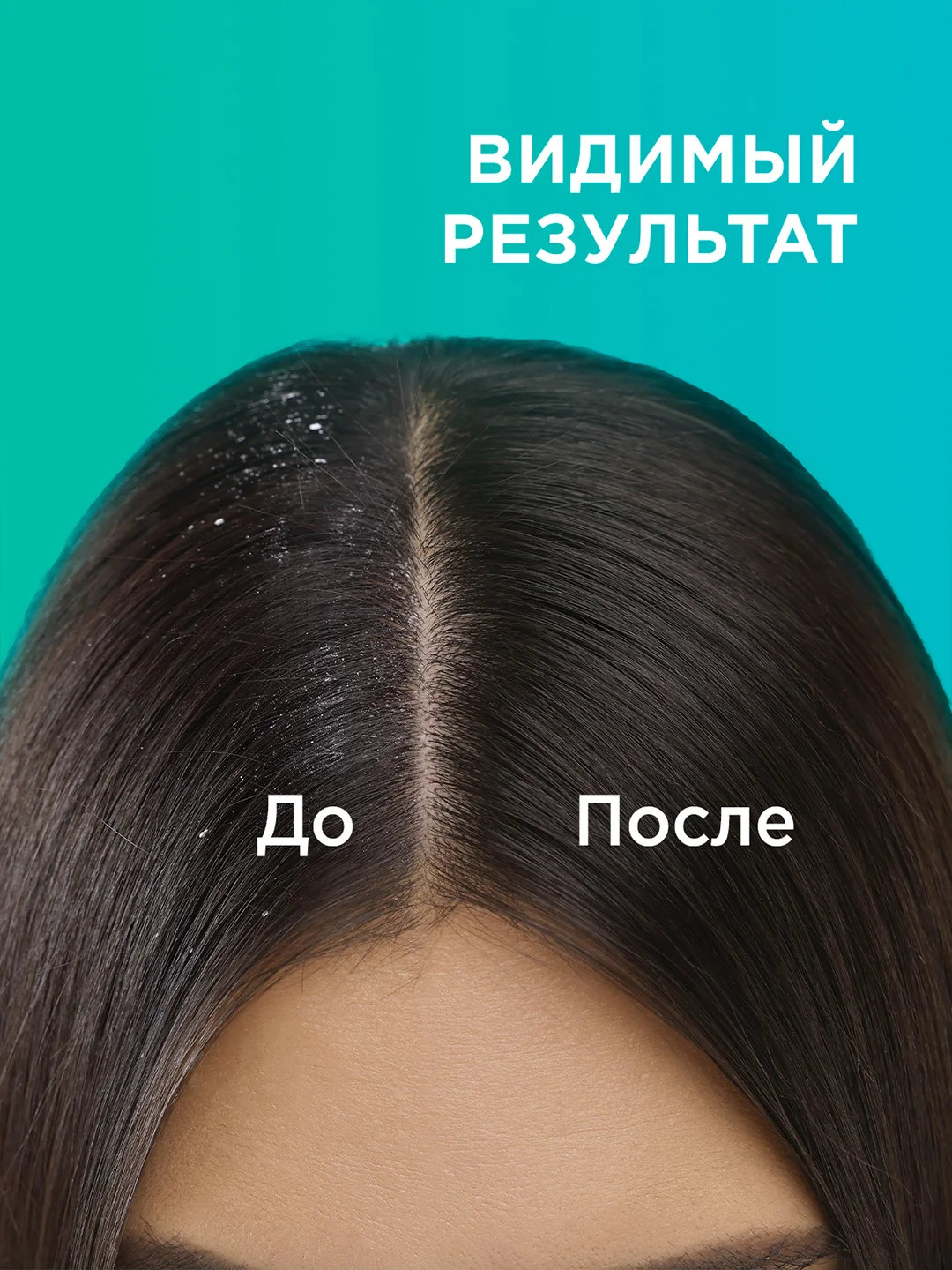 Подарочный набор MY MUSE гель для душа и шампунь-бальзам от перхоти