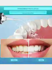 Ирригатор для зубов и десен, для полости рта, портативный,4 насадки,3 режима работы, 220мл