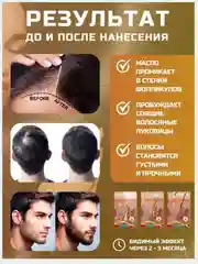 Лосьон для роста волос, сыворотка активатор для бровей и ресниц, средство против выпадения