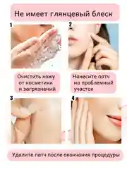 Светло-бежевый патчи от прыщей Гидроколлоидные, наклейки от прыщей и акне