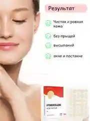 Светло-бежевый патчи от прыщей Гидроколлоидные, наклейки от прыщей и акне