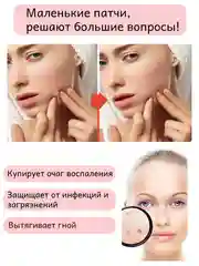 Светло-бежевый патчи от прыщей Гидроколлоидные, наклейки от прыщей и акне