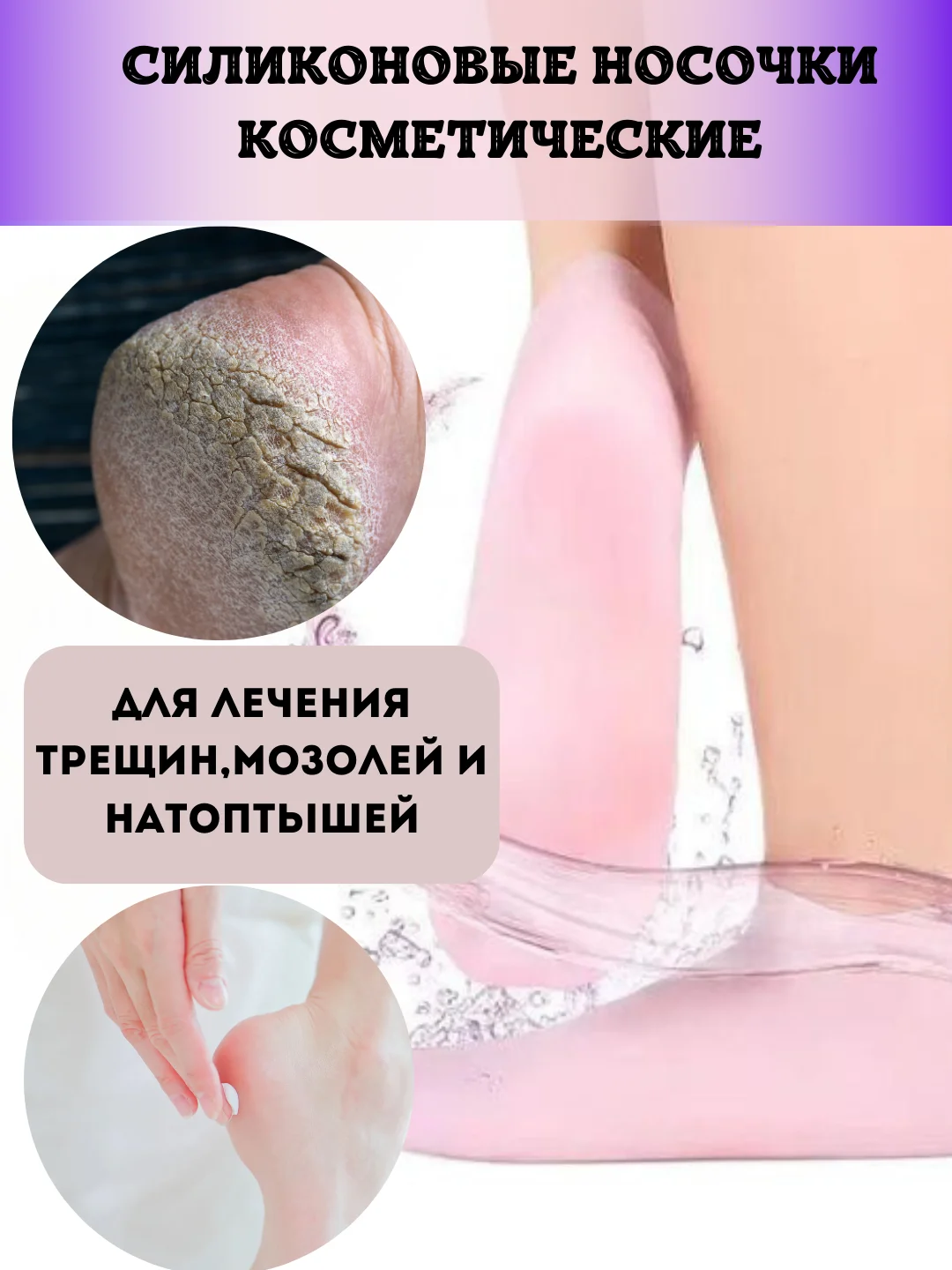 Носки для заживления трещин, косметические, силиконовые