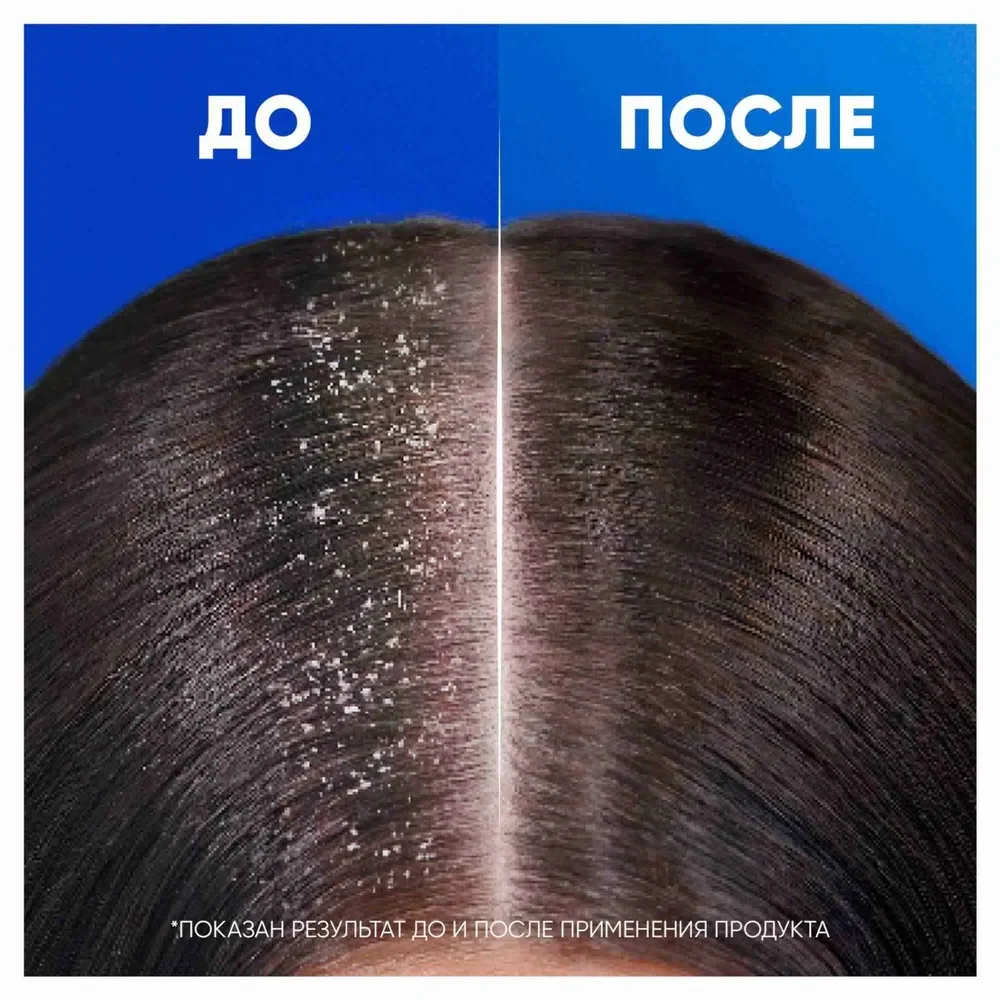 HEAD & SHOULDERS Шампунь против перхоти Sports Fresh 400мл